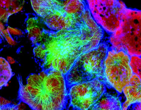 cancer cells 700x382